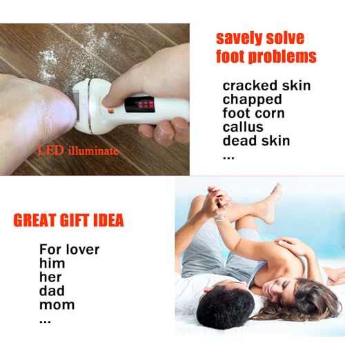 Electric Callus Remover for Feet, Long Service Time Foot Scrubber, Rechargeable Electronic Foot Files, Professional Pedicure Tools Pedicure Kit Feet Care for Crack Heel, Women Gift (White) - color: White
