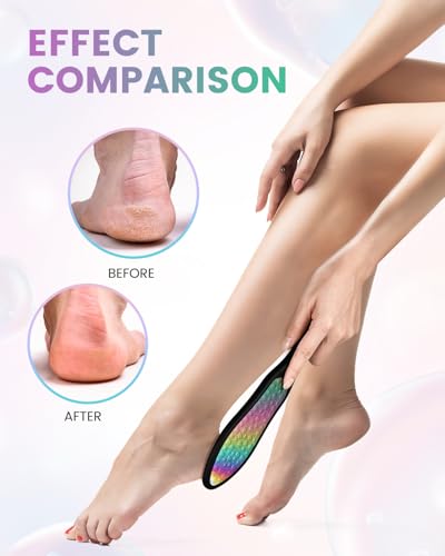 BEZOX Foot File Callus Remover(1 PCS), Double Sided Callus File Scraper, Foot Scrubber for Cracked Heel and Foot Corn Removal, Stainless Steel Pedicure File - Rainbow - style: Rainbow