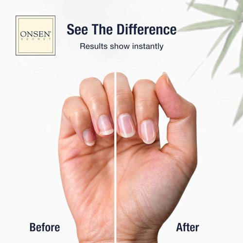 Onsen Secret Nail Care Kit - w/Cuticle Care Serum, Japanese Nail Buffer and Shine Kit - Strengthening & Shining - Spa-Quality Manicure - Organic Ingredients - Long-Lasting Shine - Easy & Safe - 1pk - size: Essential Nail Reboot Kit (Serum)