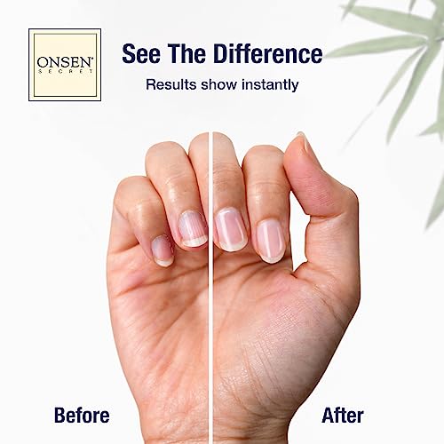 Onsen Secret Ultimate Nail Reboot Kit - Includes Cuticle Oil & Anti Aging Hand Lotion, Professional Nail File and Buffer, 3-Way Block w/Replacement Pads, Nail Strengthening Cuticle Cream - size: Ultimate Nail Reboot Kit