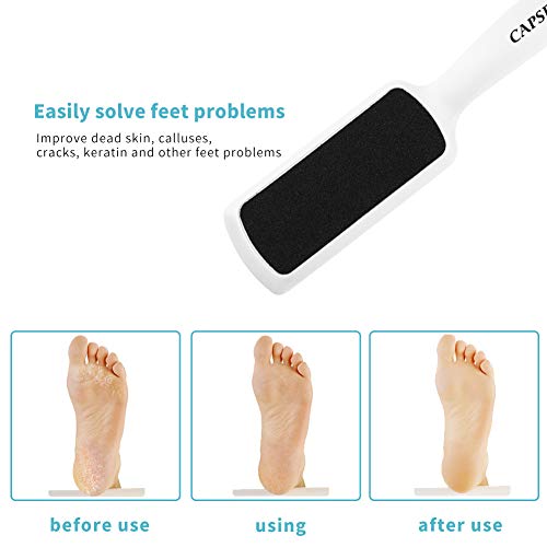 Pedicure Foot Rasp File Callus Remover, Double-Sided Colossal Foot Rasp Foot File And Callus Remover For Dead Skin (Pack of 4) - size: 1 Count (Pack of 4)