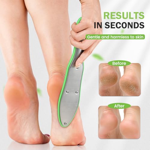 BEZOX Foot Scrubber for Dead Skin(1PCS) - Double Sided Feet File Callus Remover, Heavy Duty Stainless Steel Heel Scraper, Cracked Heel Repair - Green - style: Green