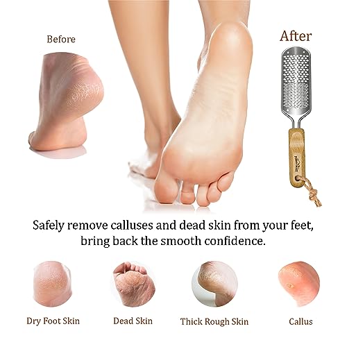 Foot Rasp Callus Remover - Pedicure Scrubber for Cracked Feet, Heel - Professional Stainless Steel File - Remove Dead Skin Corns with Wooden Handle - style: Mixed-Grained Rasp