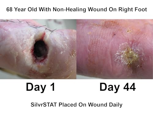 SilvrSTAT First Aid Kit Gel, 32 PPM Silver Healing Wound Dressing Gel, SilverSol Ag₄O₄ Particles, 1 oz - size: 1 Ounce