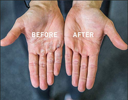 Callus Rx Callus Removal Tool | Eliminates Hard Palm Skin | No Pumice Stone or Gloves | Removes Calluses in Seconds | Best Hand Callus Remover for Workouts, WODs, Weightlifting