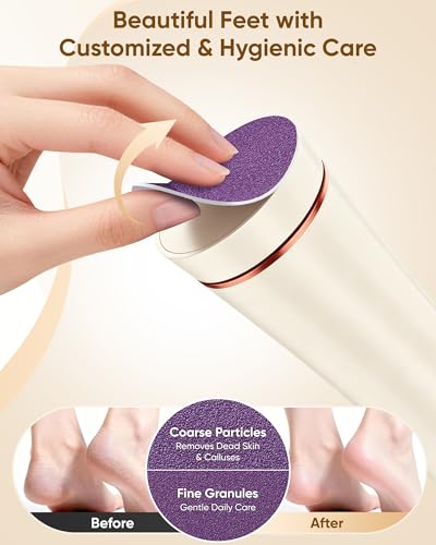 Electric Foot Callus Remover, Foot File Pedicure Tools | Waterproof Pedicure Kit, 3 Speeds, Foot Cream, Use for Hard Calluses and Cracked Heels - color: Beige