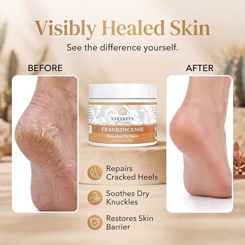 Vitality Extracts Frankincense Essential Oil Balm (2oz) – Boswellia Serrata, Beeswax & Vitamin E, Deep Moisturizing Skin Balm for Dry, Cracked Skin, Soothing & Nourishing for All Skin Types