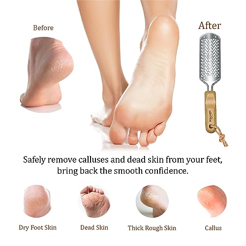 Foot Rasp Callus Remover - Pedicure Scrubber for Cracked Feet, Heel - Professional Stainless Steel File - Remove Dead Skin Corns with Wooden Handle - style: Coarse-Grained Rasp