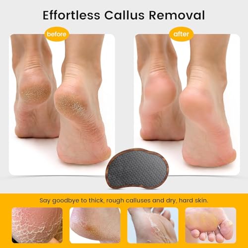 BEZOX Glass Foot File - Nano-Glass Pumice Stone Foot Scrubber, Heel File Callus Remover for Silky Smooth Feet, Portable Pedicure Tool for Summer & Vacation - Walnut Wood Handled