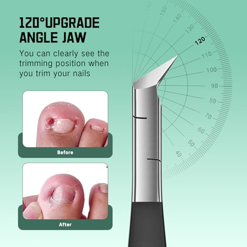 Upgrade Nail Nippers Professional Podiatrist Ingrown Toenail Clippers for Seniors Men,Slanted Eagle Beak Nail Clippers for Thick Toe Nails Cutter, Cuticle Remover Trimmer,Ingrown Toenail Scissors - style: 1PCS（120°Ingrown）