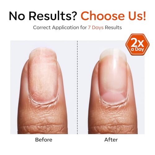 Modelones Nail Strengthener and Growth, Water-Based Nail Hardener Repair | Nail Hardener Extra Strong and Growth 3-in-1 Clear Nail Repair Mode Strengthening Polish Care Gifts Women 13.5ml 0.46 Fl Oz - color: Clear