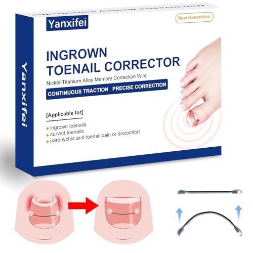 Nitinol Ingrown Toenail Corrector,at Home Ingrown Toenail Treatment,Curved Toenail Straightener,Ingrown Toe Nail Relief，Ingrown Toenail Removal Kit (11/16 In,13/16 In) - size: 11/16 In,13/16 In