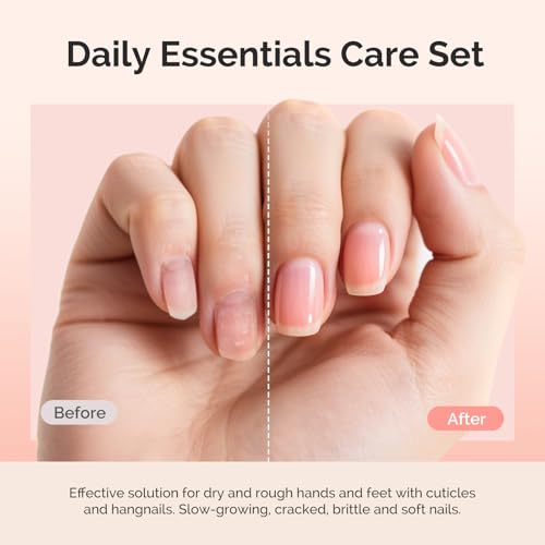 MelodySusie Cuticle Remover Kit 25ML Cuticle Remover Cream and Oil | Cuticle Nipper,Trimmer Pusher,Nail File and Brush for Cuticle Softener & Moisturize Manicure Kit for Nail Care - size: 7Pcs Milk & Honey