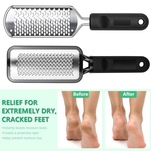Professional Pedicure File and Callus Remover - Stainless Steel Material, Ergonomic Handle, can Easily Remove Hard Skin, Callus, Dryness, Leaving Your feet Soft and Smooth (Home/Salon use)