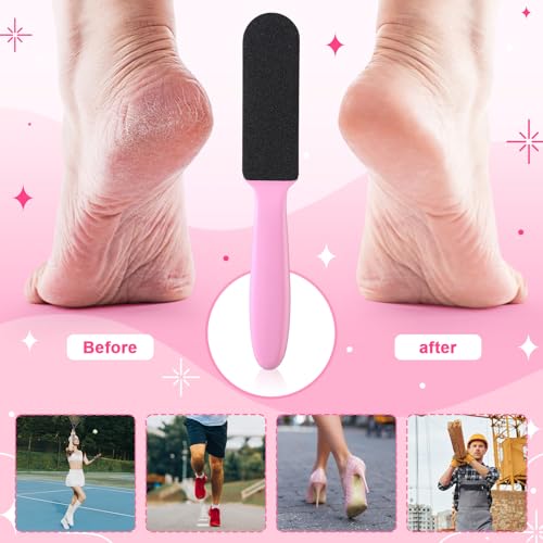 Mudder 2 Pack Stainless Steel Foot File with 20 Replaceable Double Sided Coarse & Fine Pads, Callus Remover for Dry Rough Skin and Cracked Heels, Reusable Pedicure Rasp(Pink) - color: Pink