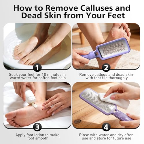 BALUCA Professional Foot File & Callus Remover - Stainless Steel Foot Rasp & Metal Feet Scrubber, Pedicure Tool for Hard Skin & Dead Skin Removal, Cracked Heel Repair for Baby Soft Feet (Purple) - color: Purple