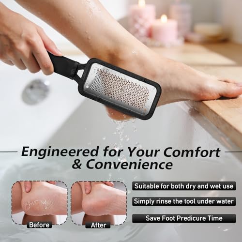BALUCA Professional Foot File & Callus Remover - Stainless Steel Foot Rasp & Metal Feet Scrubber, Pedicure Tool for Hard Skin & Dead Skin Removal, Cracked Heel Repair for Baby Soft Feet (Black) - color: Black