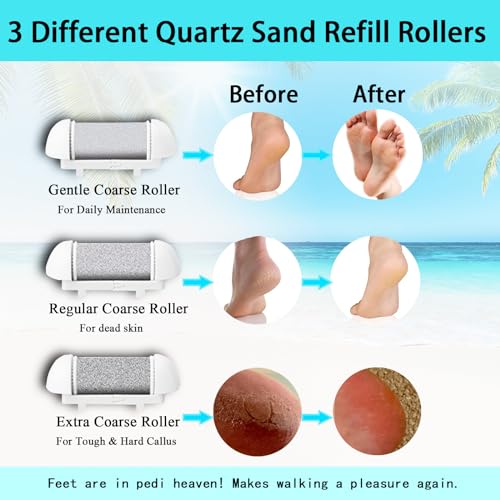 Electric Callus Remover for Feet, Long Service Time Foot Scrubber, Rechargeable Electronic Foot Files, Professional Pedicure Tools Pedicure Kit Feet Care for Crack Heel, Women Gift (White) - color: White