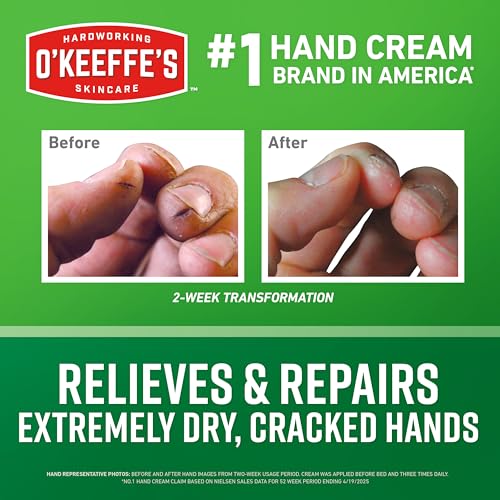 O'Keeffe's Working Hands Hand Cream, 3.4 oz Jar, 1 Pack for Extreme Dryness | Repairs Cracked, Dry Hands, Hypoallergenic, Unscented, Non-Greasy, Ideal for Repairing Skincare - size: 3.4 Ounce Jar
