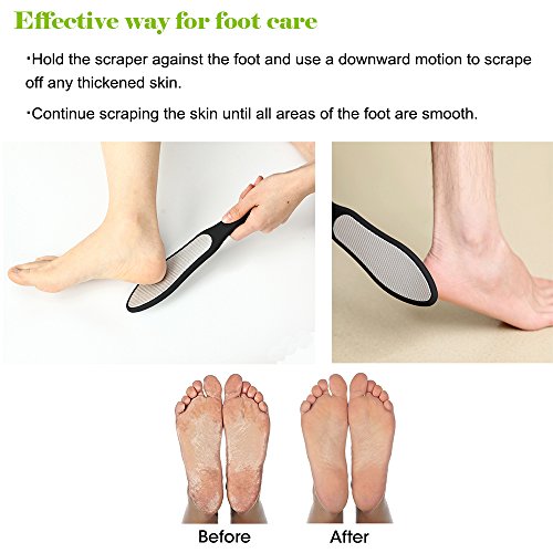 BEZOX Foot File (1 PCS), Double Sided Foot Scraper Callus Remover, Foot Rasp for Cracked Heel and Foot Corn Removal, Stainless Steel Pedicure File W/Cloth Storage Bag - style: Black