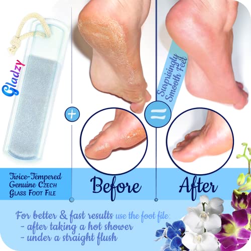 GLADZY Czech Glass Nail File Set - Multifunctional Nail Shiner Buffer, Callus Remover Foot Rasp, Glass Cuticle Pusher Manicure Stick, Etched Surface, Professional Nail Care Tool, Made in EU - color: All-in-one Set - With Shiner