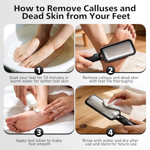 BALUCA Professional Foot File & Callus Remover - Stainless Steel Foot Rasp & Metal Feet Scrubber, Pedicure Tool for Hard Skin & Dead Skin Removal, Cracked Heel Repair for Baby Soft Feet (Black) - color: Black