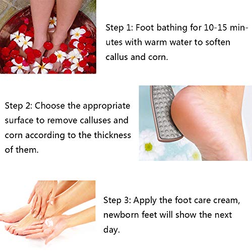 BEZOX Foot File Callus Remover, Double Sided Foot Scrubber for Dead Skin, Stainless Steel Pedicure File for Cracked Heel W/Cloth Storage Bag & Gift Box - style: Rose Golden