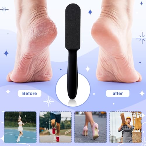 Mudder 2 Pack Stainless Steel Foot File with 20 Replaceable Double Sided Coarse & Fine Pads, Callus Remover for Dry Rough Skin and Cracked Heels, Reusable Pedicure Rasp(Black) - color: Black