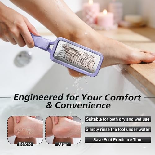 BALUCA Professional Foot File & Callus Remover - Stainless Steel Foot Rasp & Metal Feet Scrubber, Pedicure Tool for Hard Skin & Dead Skin Removal, Cracked Heel Repair for Baby Soft Feet (Purple) - color: Purple