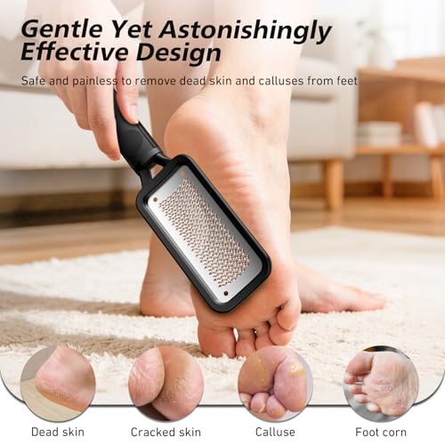 BALUCA Professional Foot File & Callus Remover - Stainless Steel Foot Rasp & Metal Feet Scrubber, Pedicure Tool for Hard Skin & Dead Skin Removal, Cracked Heel Repair for Baby Soft Feet (Black) - color: Black