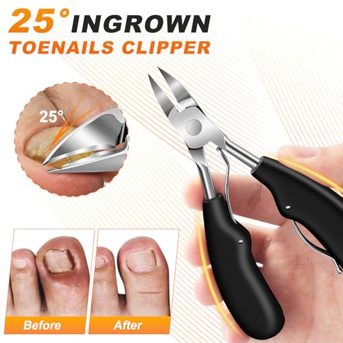 Toenail Clippers for Thick Toenails, Angled Head Toe Nail Clippers with Catcher, 360° Rotating Nail Clippers for Men, 37mm Wide Opening Nail Cutter for Ingrown Toenails, 5PCS Seniors Foot Repair Set