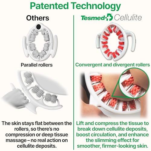 TESMED Cellulite Manual Massager Roller for Thighs and Buttocks | Made in Italy and patented, with converging and diverging roller technology for targeted anti-cellulite massage.